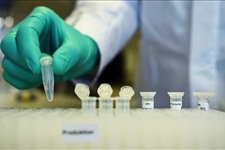 إصابات كورونا - ارشيفي 