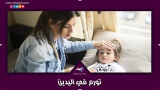 كورونا الأطفال