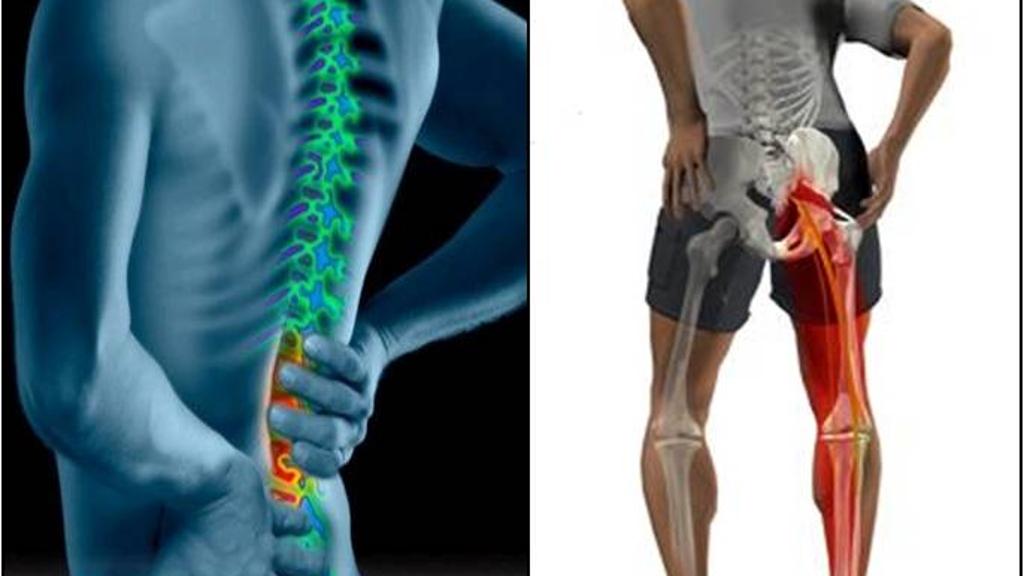 الانزلاق الغضروفي