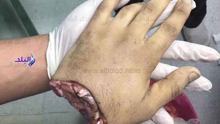 صور المصاب صور المصاب