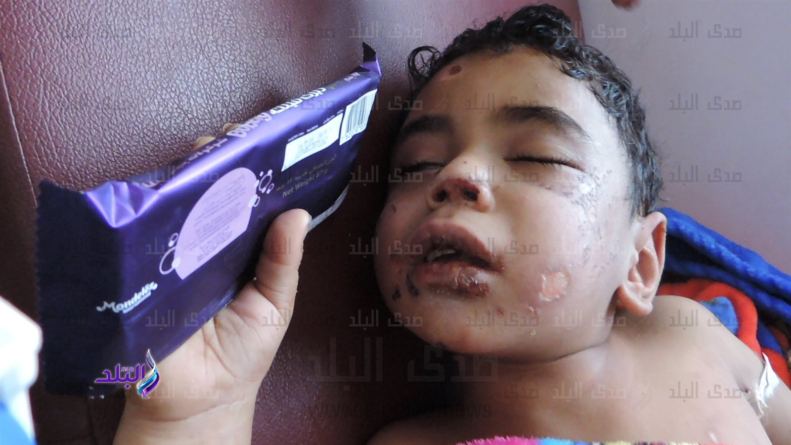 الطفل الضحية 