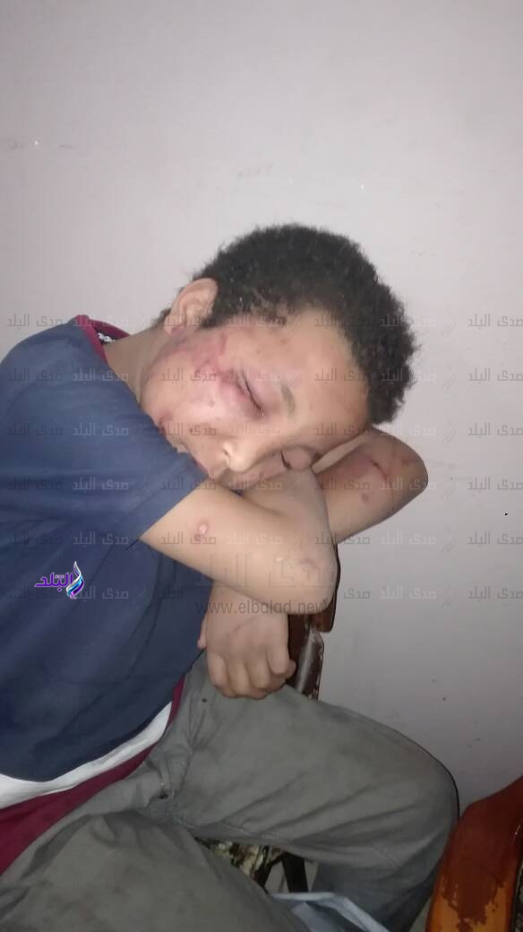 طفل امبابة
