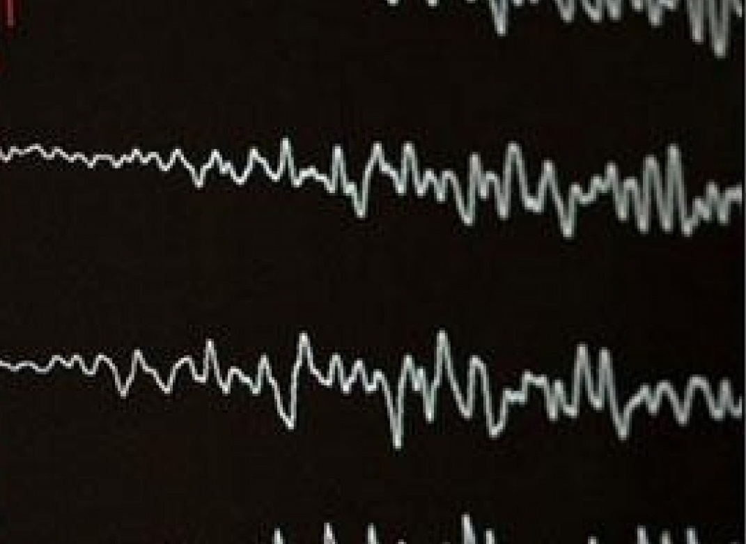 صورة ارشيفية صورة ارشيفية