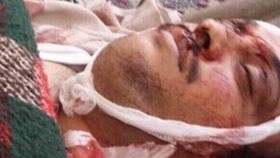 ياسر العواضي بعد مقتله  ياسر العواضي بعد مقتله