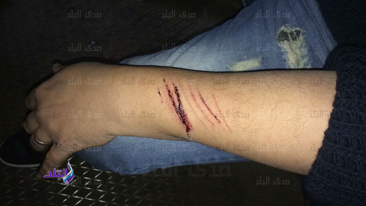 ضحية هشام جنينة 