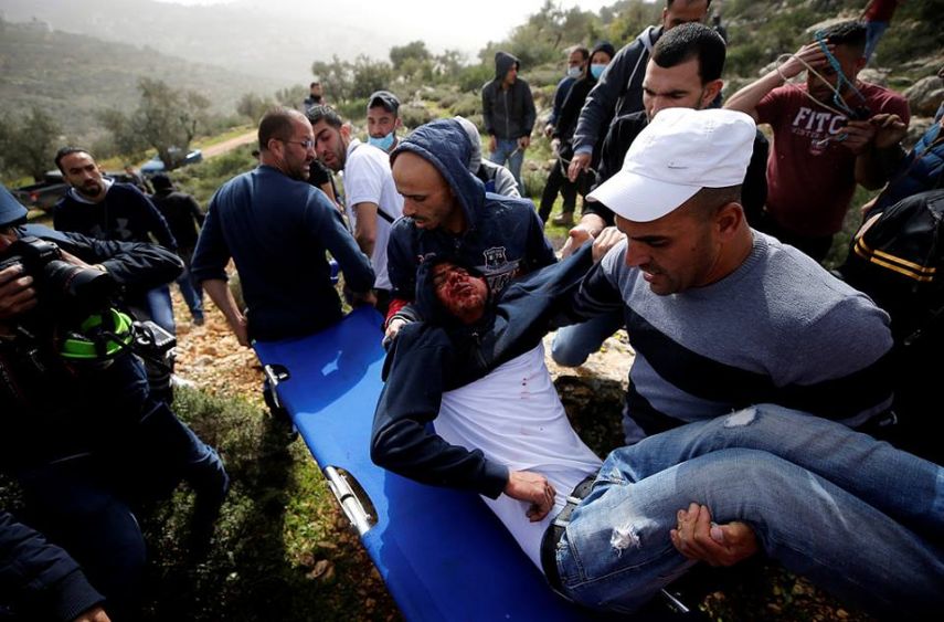 صابة شاب بالرصاص المطاطي في رأسه في القدس