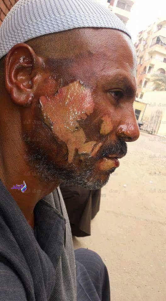 واقعة تعدي بالأقصر واقعة تعدي بالأقصر