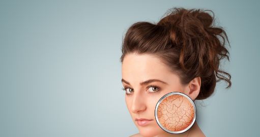 تدمر البشرة 