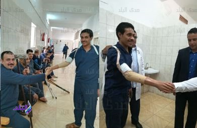 توفير اطراف صناعية لنزلاء السجون