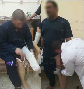 تركيب اطراف صناعية لنزلاء السجون