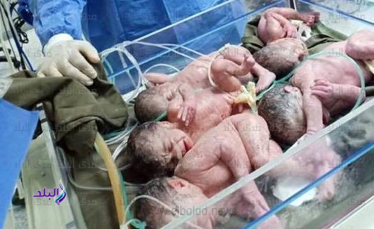 سيدة تضع 5 توائم في كفر الشيخ سيدة تضع 5 توائم في كفر الشيخ