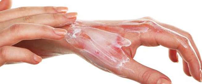  استخدام المعجون أو الثلج في التعامل مع الحروق