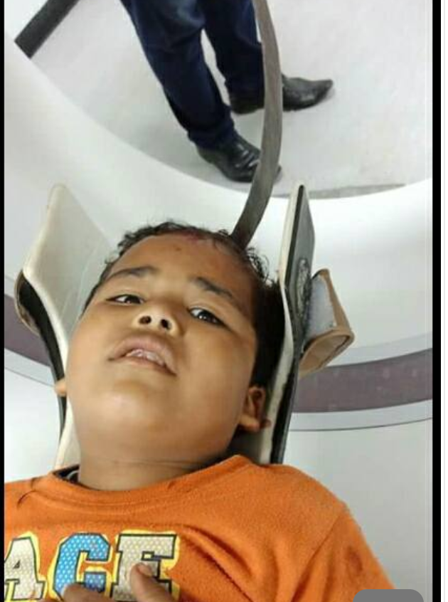طوارئ كفر سعد ينجح في إنقاذ طفل أصيب برأسه طوارئ كفر سعد ينجح في إنقاذ طفل أصيب برأسه