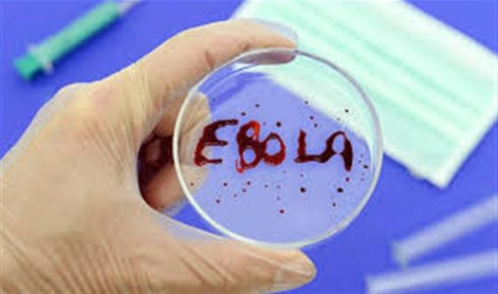 الإيبولا