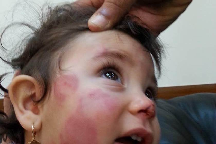 صورة أرشيفية - تعذيب طفلة صورة أرشيفية - تعذيب طفلة