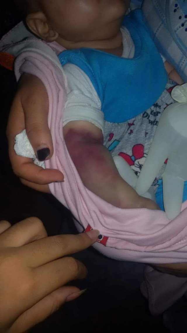 طفلة رضيعة طفلة رضيعة