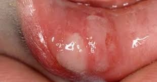  صورة أرشفية 