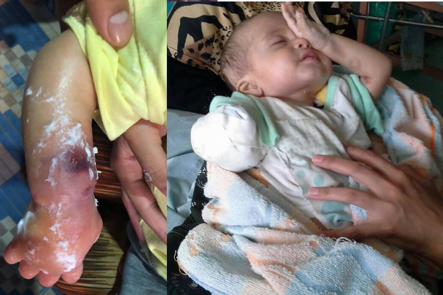  الطفل ضحية الإهمال الطبي بمستشفى أسيوط الجامعي