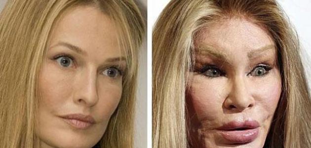 عمليات التجميل عمليات التجميل