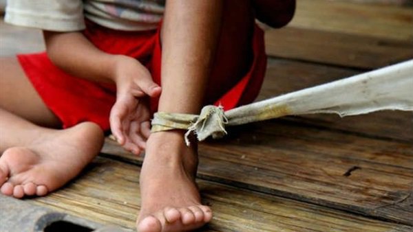 تقييد طفلة - أرشيفية تقييد طفلة - أرشيفية