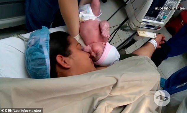 صدق أو لا تصدق :أخراج جنين من رحم اختة التوائم بذارع وساق ..