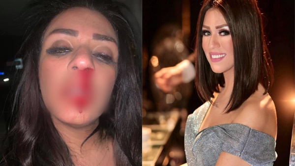 شاهيناز ضياء شاهيناز ضياء