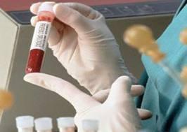 الكشف عن المخدرات