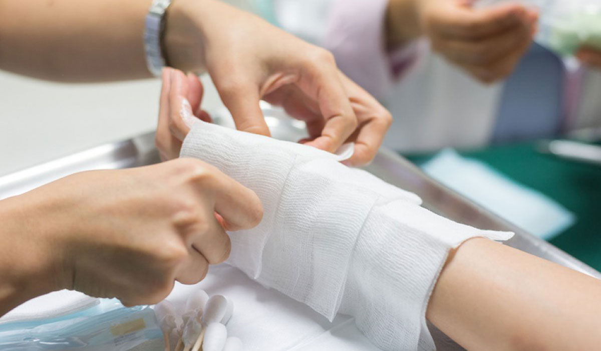 الناظر يكشف خطورة وضع المعجون على الحروق