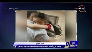 فرح أول حالة قلب صناعي بمصر