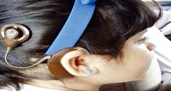 زراعة قوقعة 