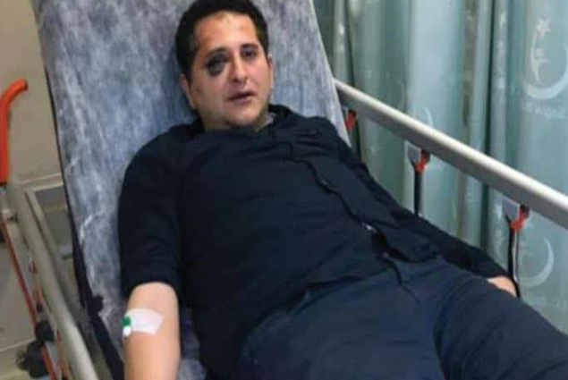 محامي تركي تعرض للضرب من قبل حراسة أردوغان