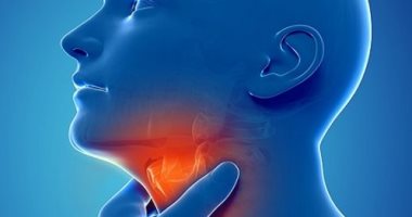 ارتجاع المريء -  تعبيرية 