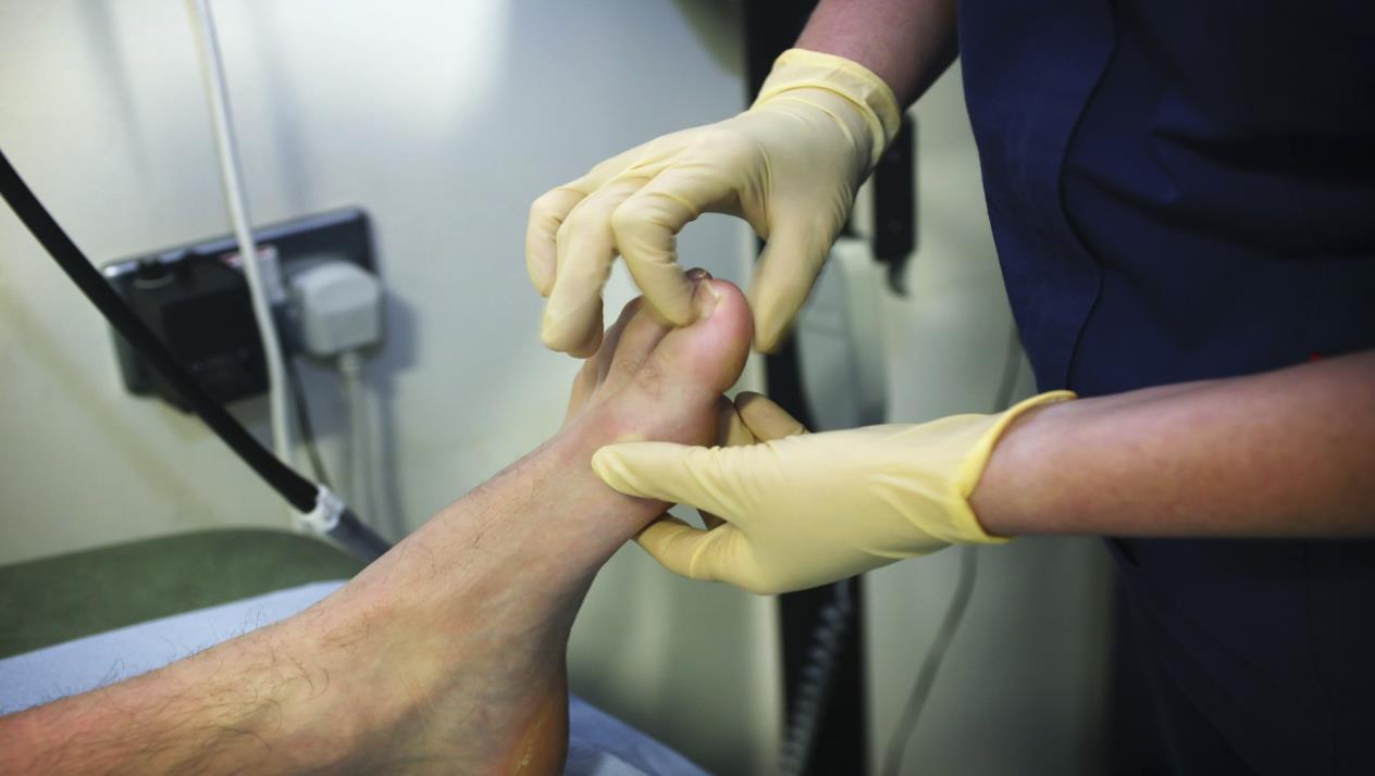 طرق تشخيص النقرس