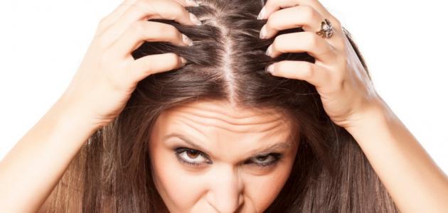 علاج القمل