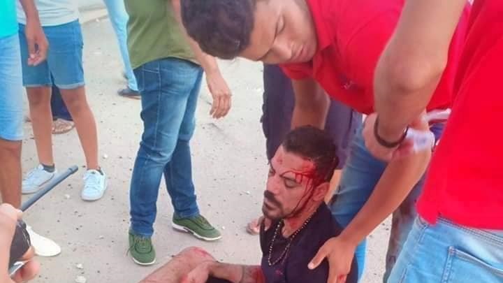 عمرو زكى عقب خروجه من سيارته بعد الحادث