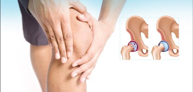 اسباب الم المفاصل .. 25 سبب مختلف وراء المعاناة منها اسباب الم المفاصل .. 25 سبب مختلف وراء المعاناة منها
