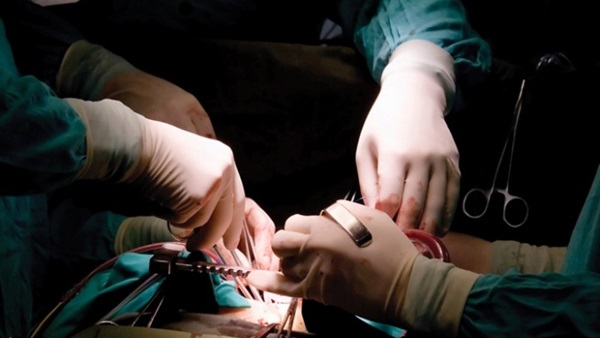 الاتجار فى الاعضاء البشرية 