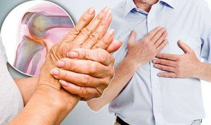 أحترس أعراض تؤكد أصابتك بالروماتويد
