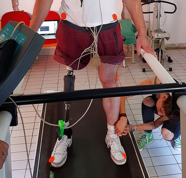 طرف صناعي تكنولوجي