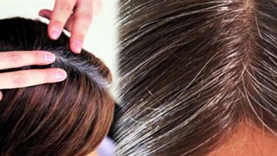 الشعر الابيض 