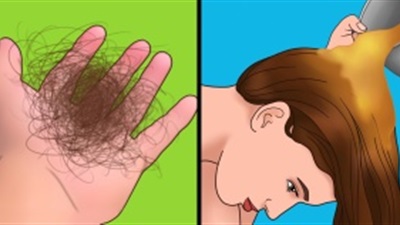 تساقط الشعر