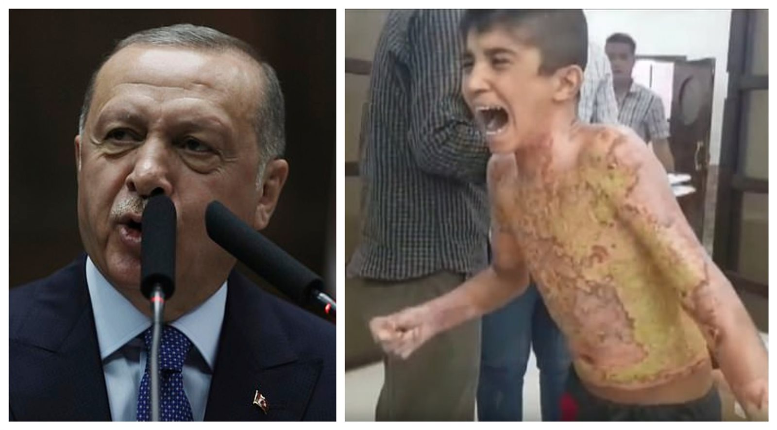 حرب أردوغان على الأطفال الأكراد بأسلحة محرمة دوليًا