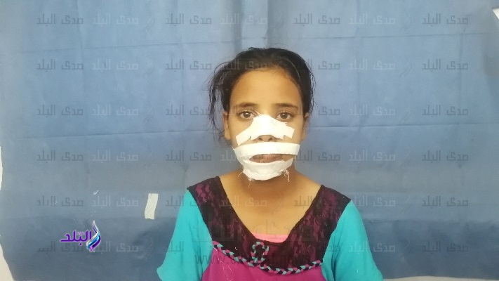 الطفلة الضحية