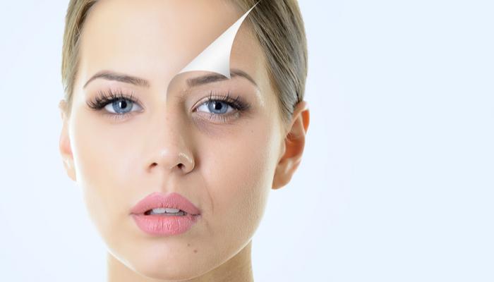 ماسك البطاطس والليمون.. وصفة مذهلة لعلاج الحروق والتجاعيد