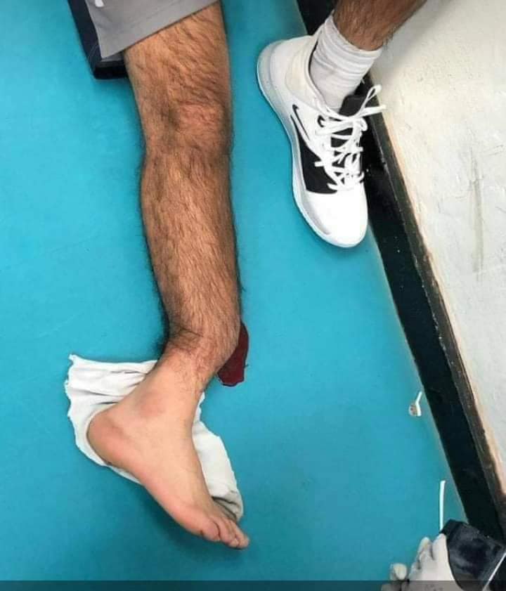 أندريا جوميز