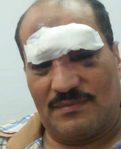 إصابة سائق قطار المنصورة