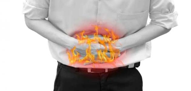 علاج الحموضة بالاعشاب .. 8 مشروبات طبيعية تزيل الألم علاج الحموضة بالاعشاب .. 8 مشروبات طبيعية تزيل الألم