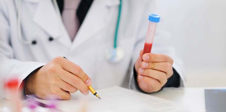 علاج ارتفاع الكوليسترول في الدم 