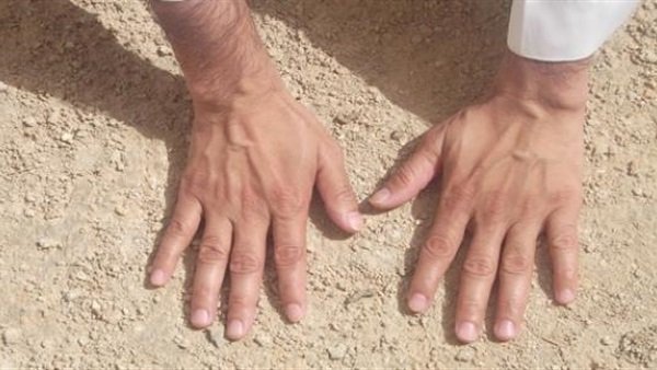 هل يجوز التيمم لمن أجرى عملية جراحية ؟ هل يجوز التيمم لمن أجرى عملية جراحية ؟