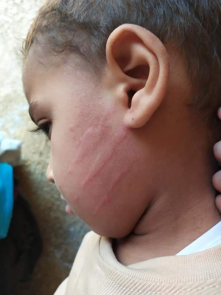 صفعة تلميذ بالصف الاول الابتدائي